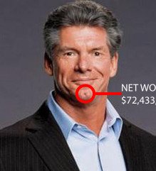 Vince McMahon chin