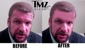 Triple-H forehead
