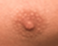 nipple