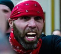 Nick gage teeth