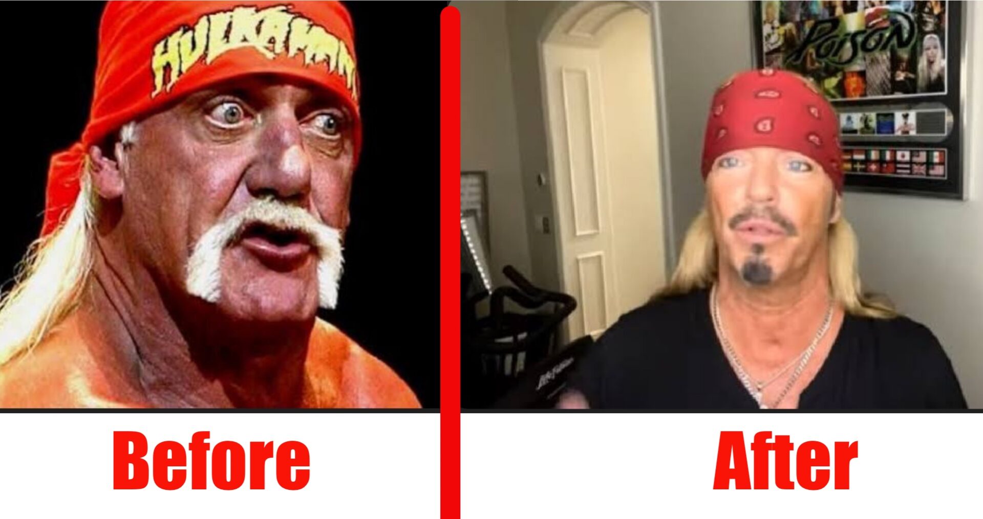 Hulk Hogan looks decades younger following plastic surgery