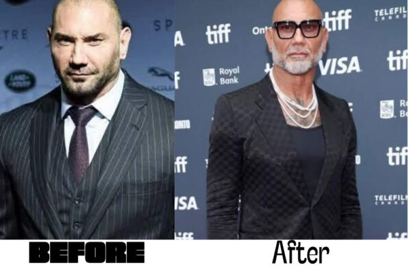 Batista thin
